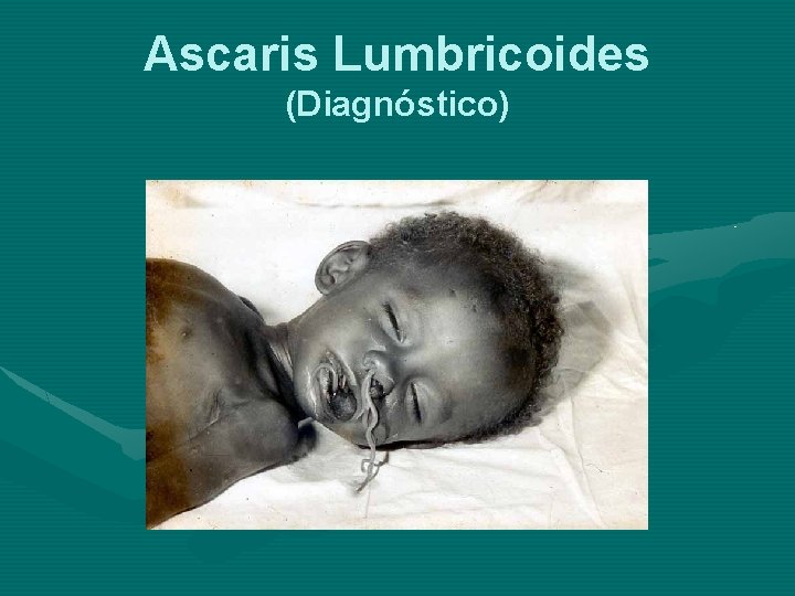 Ascaris Lumbricoides (Diagnóstico) 