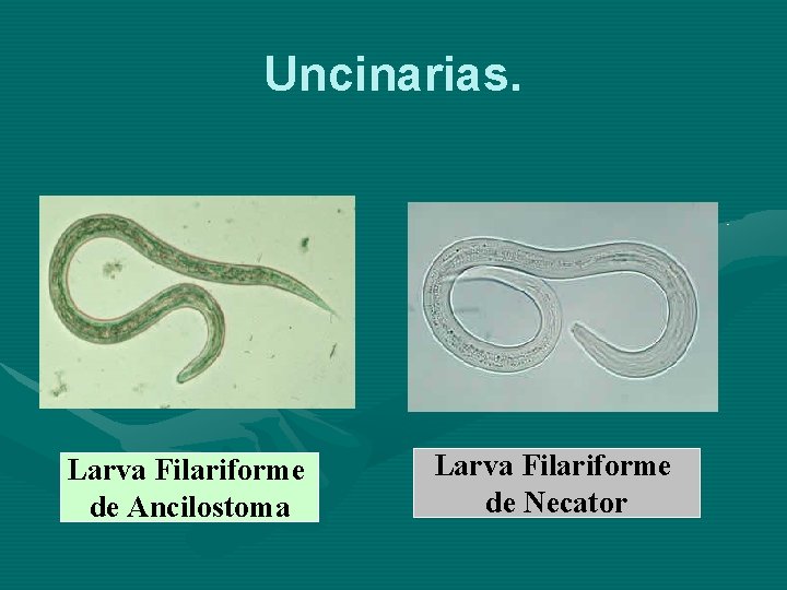 Uncinarias. Larva Filariforme de Ancilostoma Larva Filariforme de Necator 