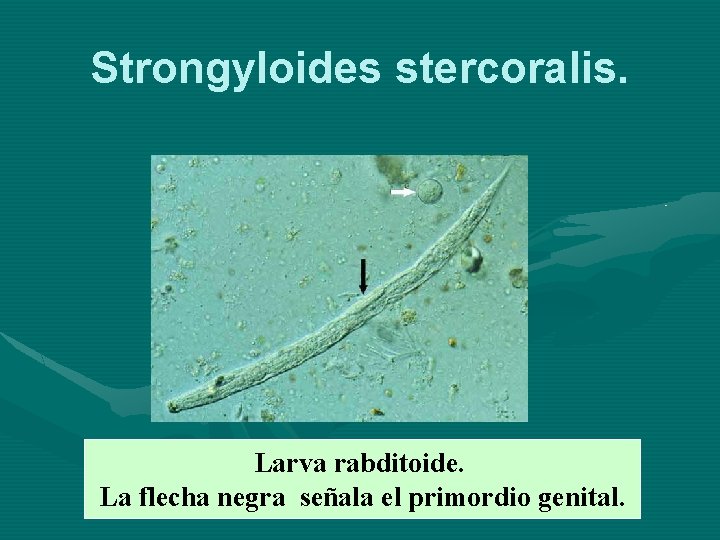 Strongyloides stercoralis. Larva rabditoide. La flecha negra señala el primordio genital. 