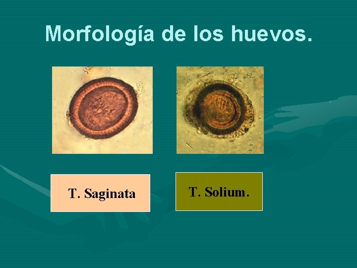 Morfología de los huevos. T. Saginata T. Solium. 