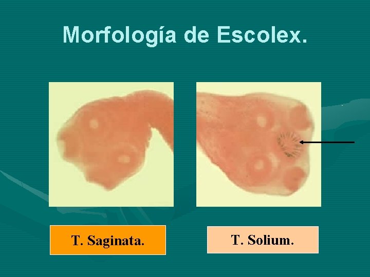 Morfología de Escolex. T. Saginata. T. Solium. 