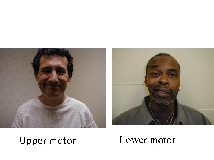 Upper motor Lower motor 