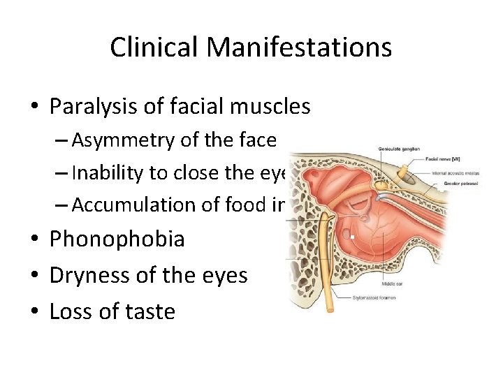 Clinical Manifestations • Paralysis of facial muscles – Asymmetry of the face – Inability