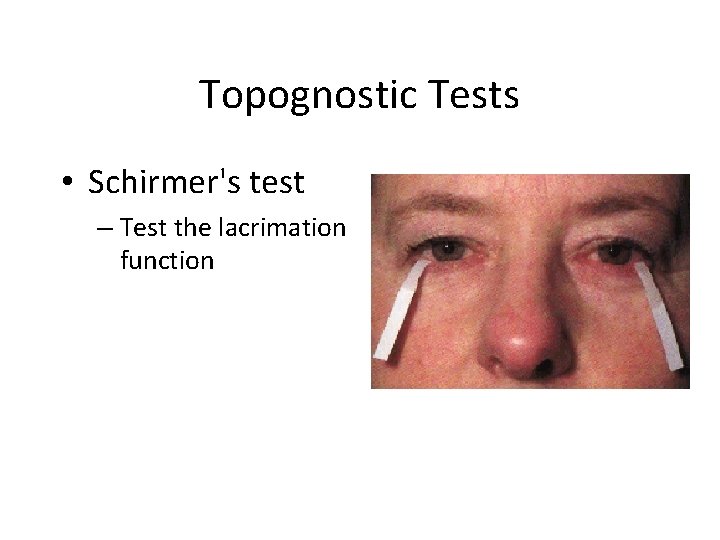 Topognostic Tests • Schirmer's test – Test the lacrimation function 