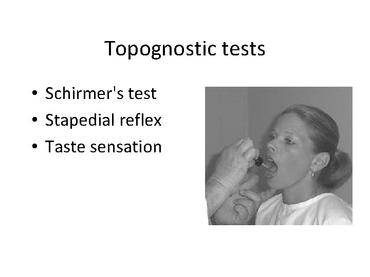 Topognostic tests • Schirmer's test • Stapedial reflex • Taste sensation 