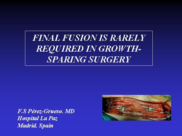 FINAL FUSION IS RARELY REQUIRED IN GROWTHSPARING SURGERY F. S Pérez-Grueso. MD Hospital La