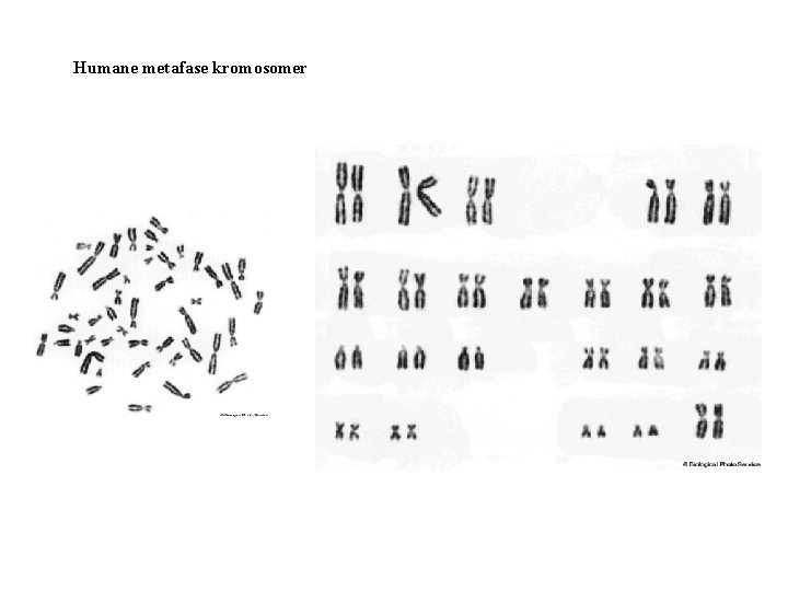 Humane metafase kromosomer 