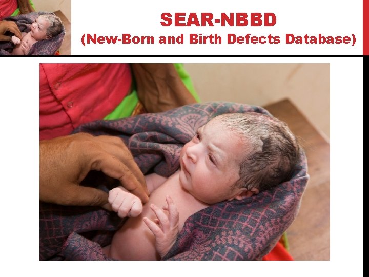 SEAR-NBBD (New-Born and Birth Defects Database) 