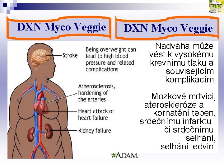 DXN Myco Veggie Nadváha může vést k vysokému krevnímu tlaku a souvisejícím komplikacím: Mozkové