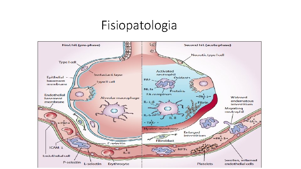 Fisiopatologia 