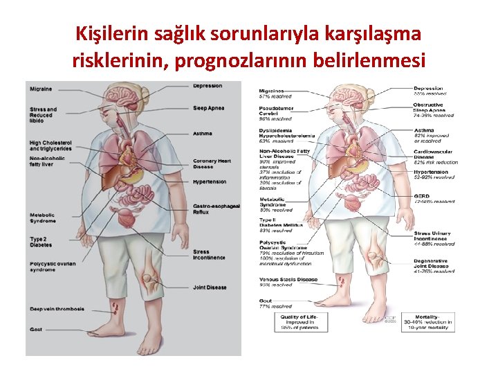 Kişilerin sağlık sorunlarıyla karşılaşma risklerinin, prognozlarının belirlenmesi 