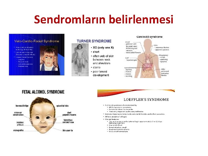 Sendromların belirlenmesi 