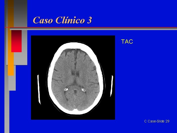 Caso Clínico 3 TAC C Case-Slide 29 