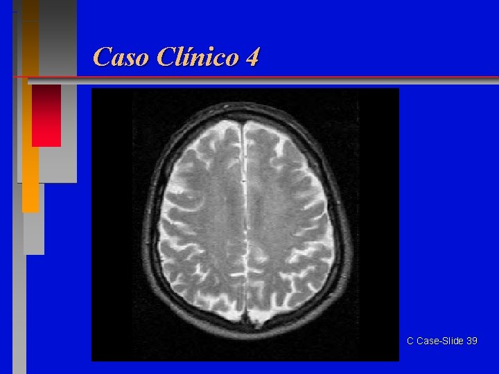 Caso Clínico 4 C Case-Slide 39 