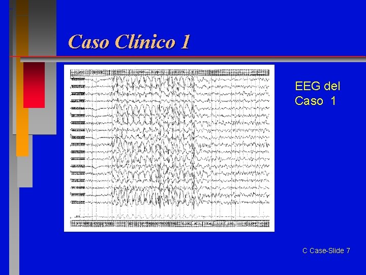 Caso Clínico 1 EEG del Caso 1 C Case-Slide 7 