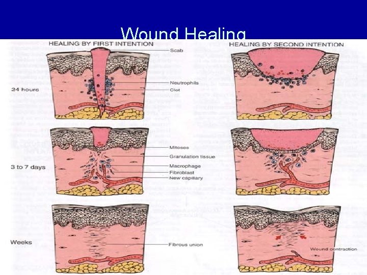 Wound Healing 52 