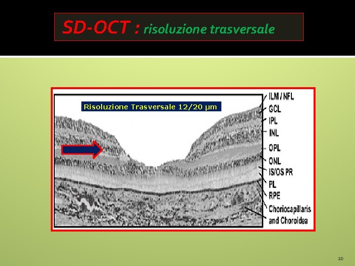 SD-OCT : risoluzione trasversale Risoluzione Trasversale 12/20 µm 10 