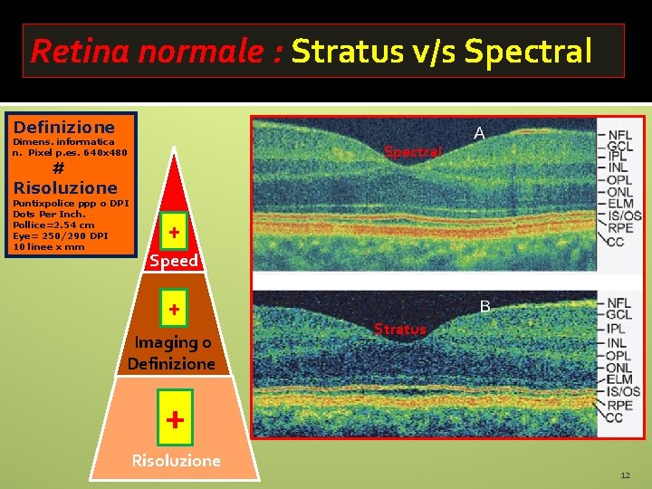 Retina normale : Stratus v/s Spectral Definizione Dimens. informatica n. Pixel p. es. 640