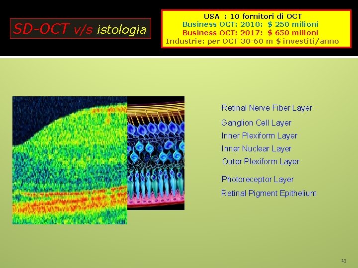 SD-OCT v/s istologia USA : 10 fornitori di OCT Business OCT: 2010: $ 250