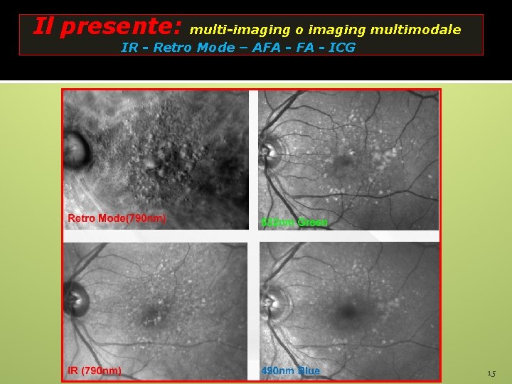 Il presente: multi-imaging o imaging multimodale IR - Retro Mode – AFA - ICG