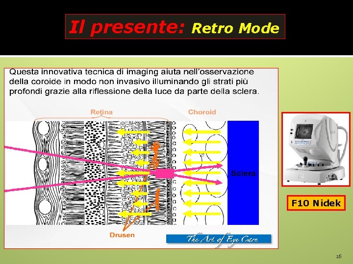 Il presente: Retro Mode F 10 Nidek 16 