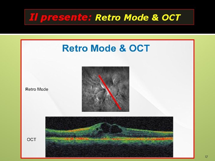 Il presente: Retro Mode & OCT 17 