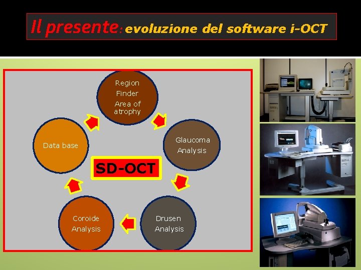 Il presente: evoluzione del software i-OCT Region Finder Area of atrophy Glaucoma Data base