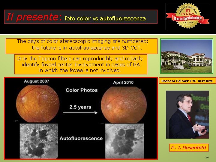 Il presente: foto color vs autofluorescenza The days of color stereoscopic imaging are numbered;