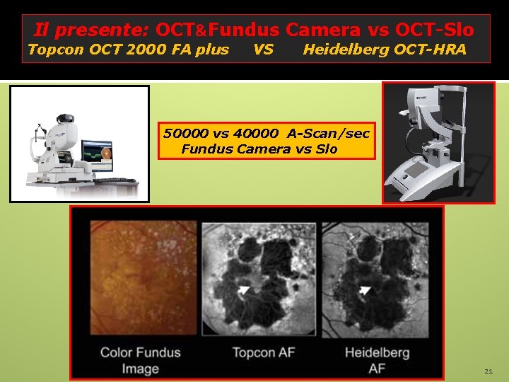 Il presente: OCT&Fundus Camera vs OCT-Slo Topcon OCT 2000 FA plus VS Heidelberg OCT-HRA