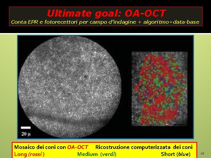 Ultimate goal: OA-OCT Conta EPR e fotorecettori per campo d’indagine + algoritmo+data-base Mosaico dei