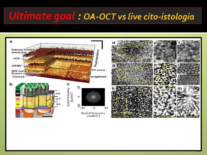 Ultimate goal : OA-OCT vs live cito-istologia 28 