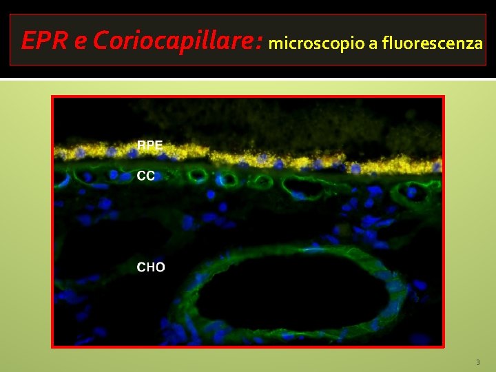 EPR e Coriocapillare: microscopio a fluorescenza 3 
