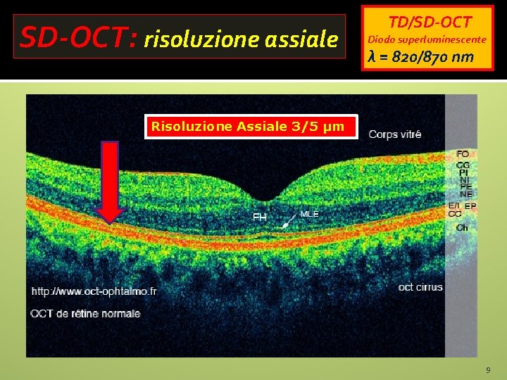 SD-OCT: risoluzione assiale TD/SD-OCT Diodo superluminescente λ = 820/870 nm Risoluzione Assiale 3/5 µm