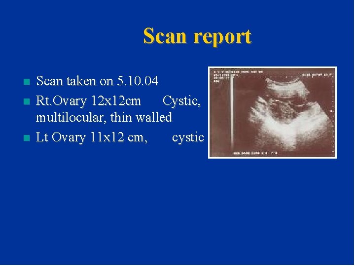 Scan report n n n Scan taken on 5. 10. 04 Rt. Ovary 12 Scan report n n n Scan taken on 5. 10. 04 Rt. Ovary 12