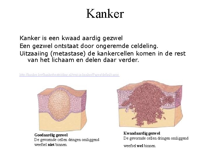 Kanker is een kwaad aardig gezwel Een gezwel ontstaat door ongeremde celdeling. Uitzaaiing (metastase)