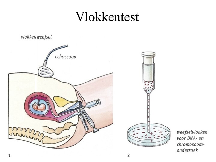 Vlokkentest 