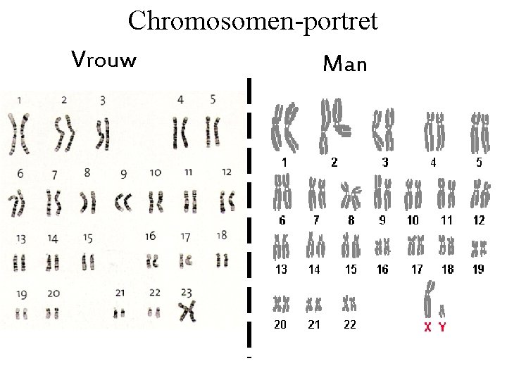 Chromosomen-portret Vrouw Man 