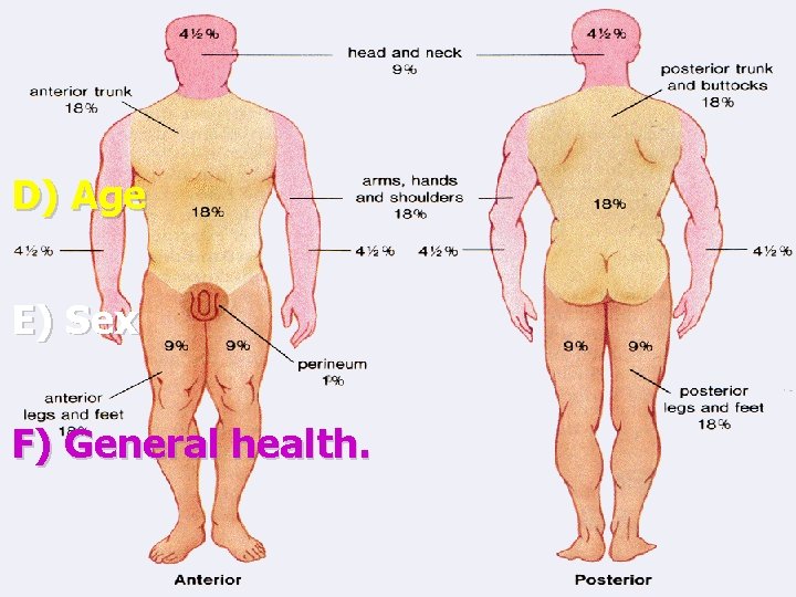 Factors affecting degree of burn A) Extent of burnt area: D) Age is determined