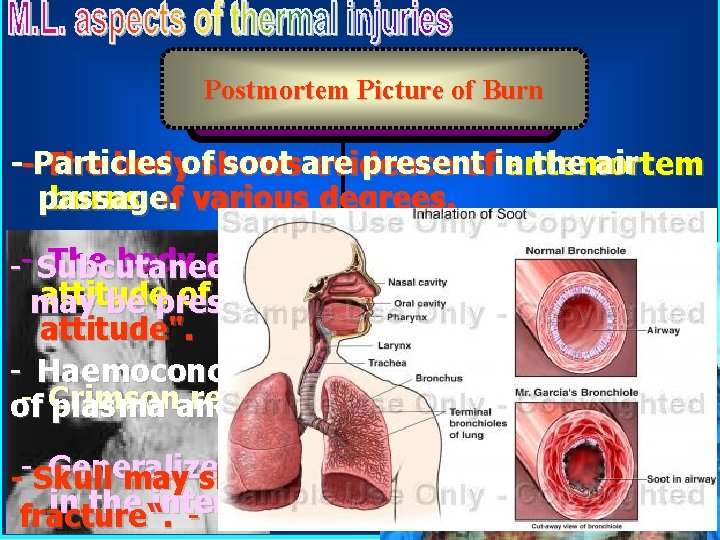 Postmortem Picture of Burn Complications of Burn --Particles soot are present the air The