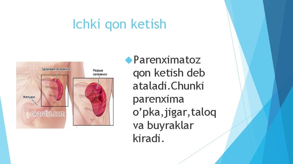 Ichki qon ketish Parenximatoz qon ketish deb ataladi. Chunki parenxima o’pka, jigar, taloq va