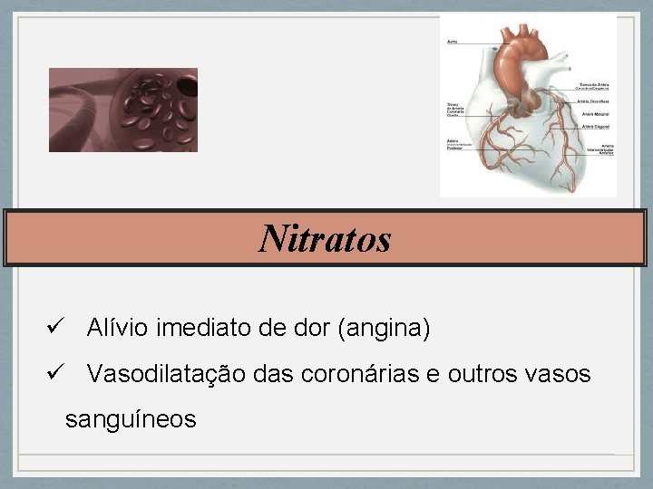 Nitratos ü Alívio imediato de dor (angina) ü Vasodilatação das coronárias e outros vasos