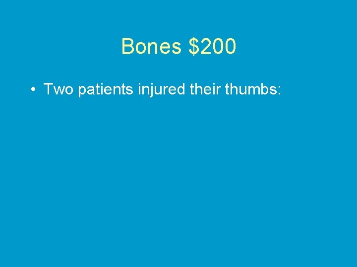 Bones $200 • Two patients injured their thumbs: 