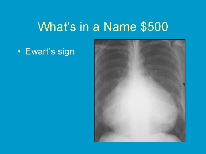 What’s in a Name $500 • Ewart’s sign 