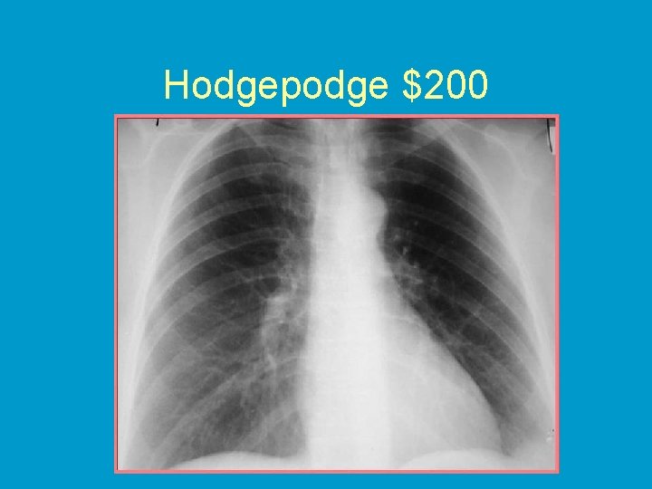 Hodgepodge $200 