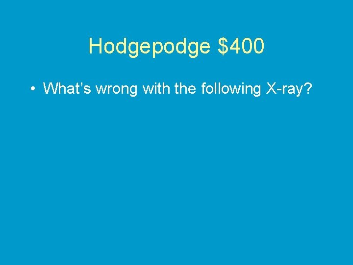 Hodgepodge $400 • What’s wrong with the following X-ray? 