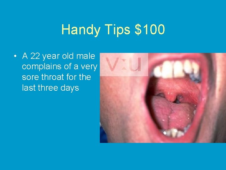 Handy Tips $100 • A 22 year old male complains of a very sore