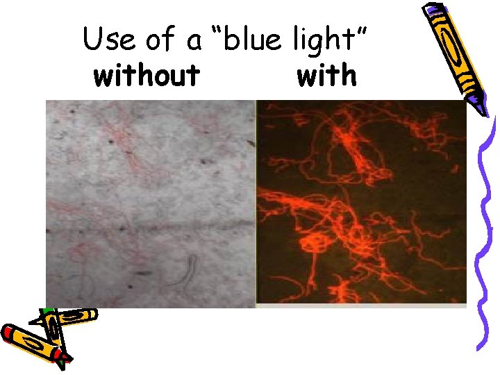 Use of a “blue light” without with 