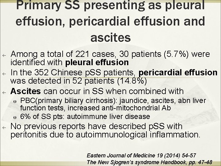 Primary SS presenting as pleural effusion, pericardial effusion and ascites ß ß ß Among Primary SS presenting as pleural effusion, pericardial effusion and ascites ß ß ß Among