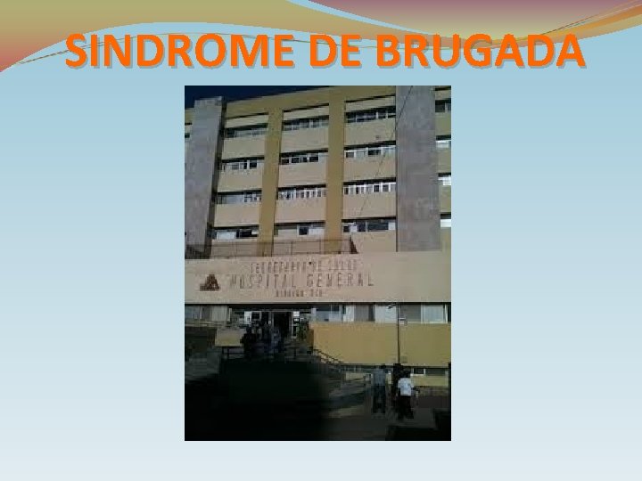 SINDROME DE BRUGADA 