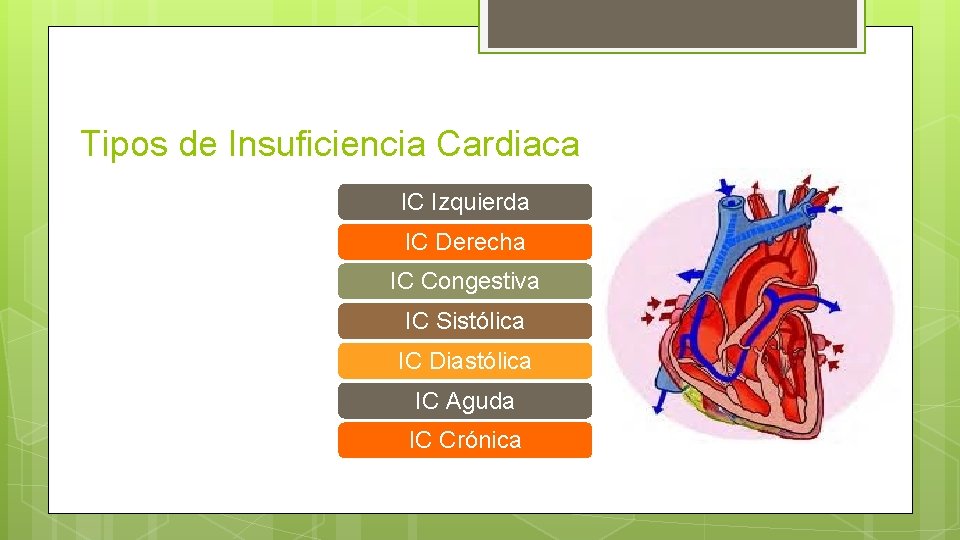 Tipos de Insuficiencia Cardiaca IC Izquierda IC Derecha IC Congestiva IC Sistólica IC Diastólica